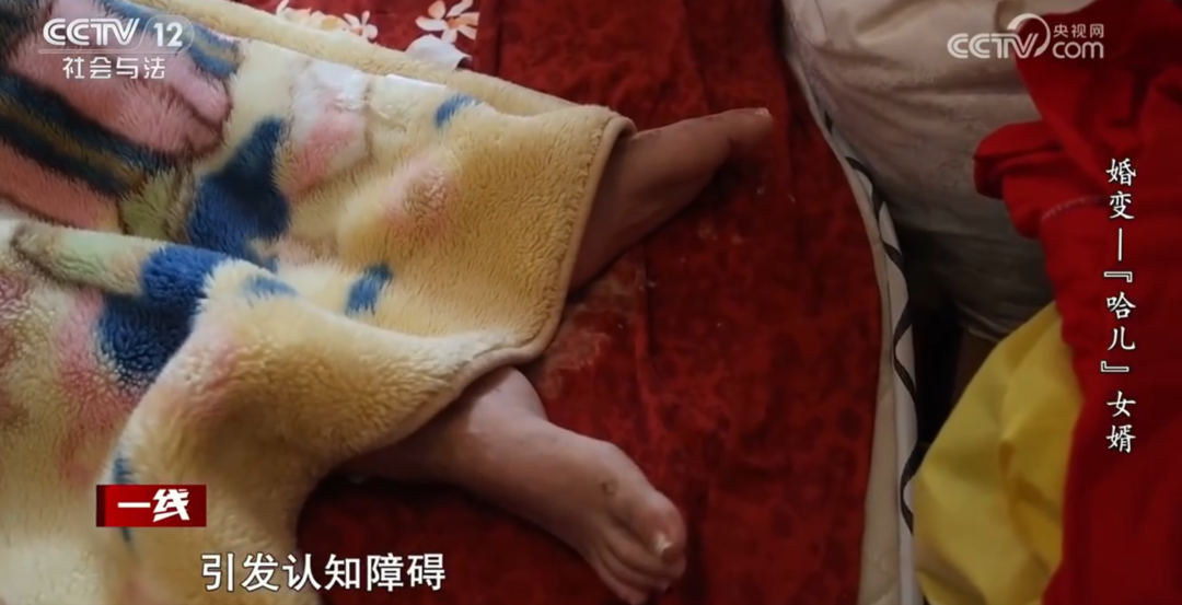 女子在丈夫瘫痪期间另交男友并怀孕，要求离婚，丈夫不同意！离婚官司开打，岳父竟是女婿的代理人……